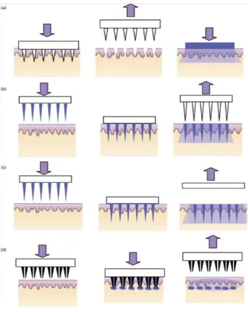 Figure 3 : Methodology for drug delivery by microneedles: (a) ‘poke and patch’ using solid microneedles, (b) ‘coat and poke’ using coated solid microneedles, (c) ‘poke and release’ using polymeric microneedles, (d) ‘poke and flow’ using hollow microneedles