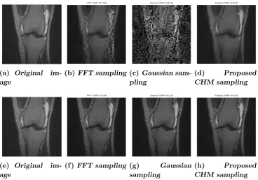 Figure 3.5: Reconstructed data for a 256×256 spine MRI image with 4K samples(from (b) to (d)) and 10K samples (from (f) to (h)).