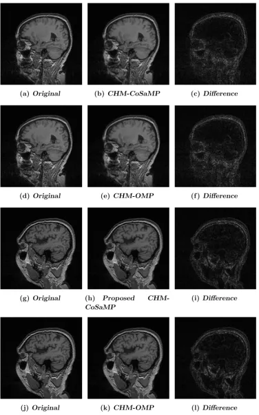 Figure 3.9: Fully sampled and reconstructed images for a 256×256 single 2D sliceof a 3D dataset