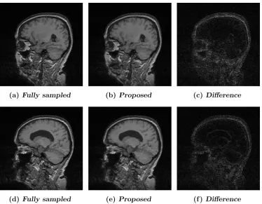 Figure 5.4: Reconstructed images of a two slices ((a) and (d)) from a total MRIscan samples of dataset-1 [1].