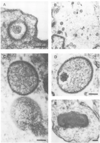 FIG. 5.particleDNA,typical= 0.1 Electron micrographs of thin sections of vaccinia virus-infected BSC-40 cells