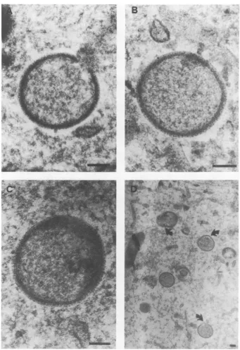 FIG. 6.3Barnant(D) h. Electron micrographs of thin sections of vaccinia virus-infected BSC-40 cytoplasts
