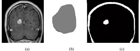 Fig. 2. Result of  Histogram Thresholding ,  (a) Original Input Image , (b) Manually segmented brain MRI, (c)Output of Histogram Thresholding