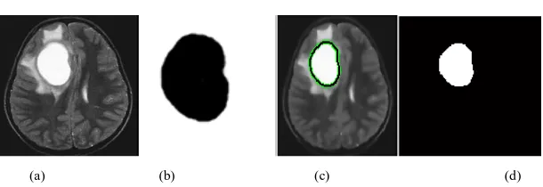 Fig. 5.Result of SVM method, (a) Original Input Image, ( b) Manually segmented brain MRI, (c) SVM classifier, (d) Segmented image