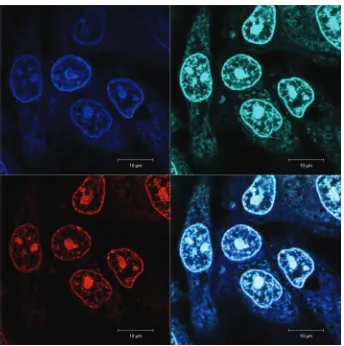 Fig. 5ΔΔ-Rubb12 localisation in Hep-G2 cells at 5 µM (20 hour incubation), stained with DAPI (blue; top left), SYTO 9 (cyan; top right), ΔΔ-Rubb12(red; bottom left) and merged (bottom right), where the light colouration arises from co-localisation of SYTO 