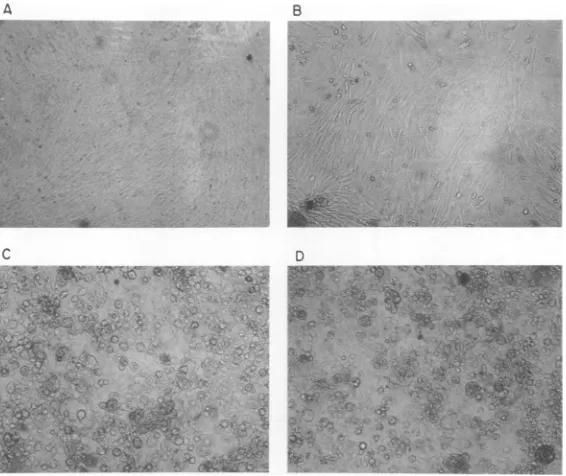 FIG. 4.duckproductdetergent-disruptedby detergent-disrupted Morphology of chicken embryo fibroblasts after transfection with DNA product synthesized by RSV in vitro