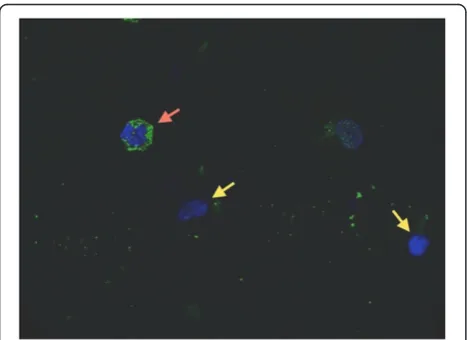 Figure 3 Pentraxin 3 is stored in alveolar cell granules.Immunostained images show intracellular presence of Pentraxin 3(PTX3) inside one cell (red arrow) recovered from the alveolar space ofan intubated critically ill patient