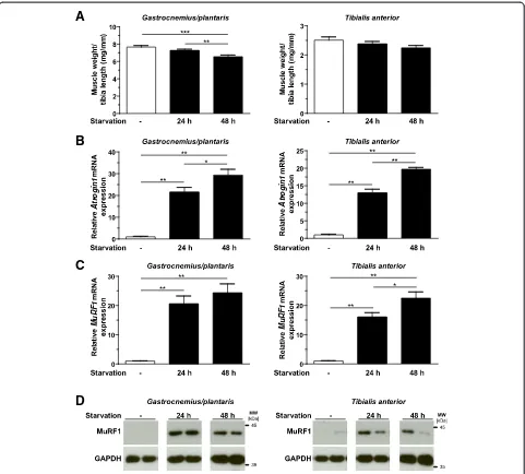Figure 5 Starvation leads to skeletal muscle atrophyRT-PCR analyses ofand tibialis anterior muscles of control animals (3-phosphate dehydrogenase (Gapdh) expression and protein content were used as reference values, and data shown are fold changescompared 