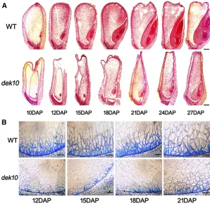 Figure 2 Developmental delay of(12 DAP, 15 DAP, 18 DAP, and 21 DAP). Bar, 100BETL, basal endosperm transfer layer; DAP, days after pol-15 DAP, 18 DAP, 21 DAP, 24 DAP, and 27 DAPand WT kernels