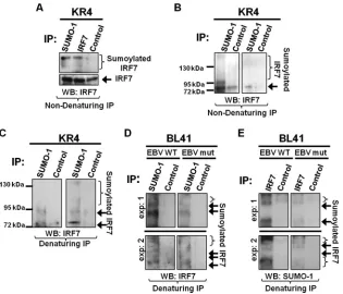 FIG 1 IRF7 is sumoylated endogenously in type III EBV LCLs. (A to C) KR4 cells were grown, and cell lysates were collected