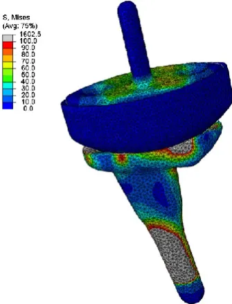 Figure 4b. Strain distribution on the polyethylene 