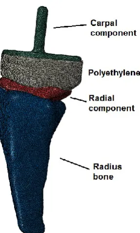 Figure 1a – Finite element model of the 
