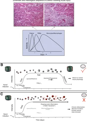 Figure 1. Schematic depicting the cellular andmolecular components of the inﬂammatoryresponse and the requirements for resolution.A) (adapted from Cotran; see ref