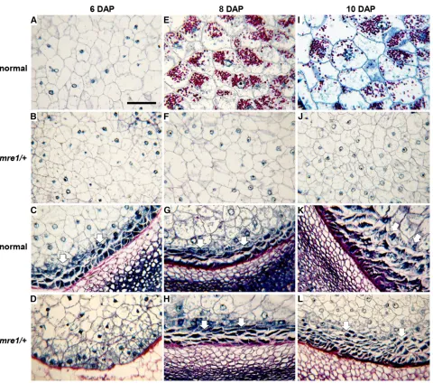Figure 5 Endosperm development defects inthe springendosperm offuschia; nucleoli, nuclei, and cytoplasm stain different intensities of blue