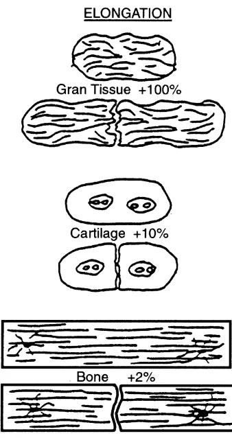 Figure 3: Interfragmentary Strain Theory: A tissue cannot exist in an environment where the interfragmentary strain exceeds the strain tolerance of the extracellular matrix of the tissue