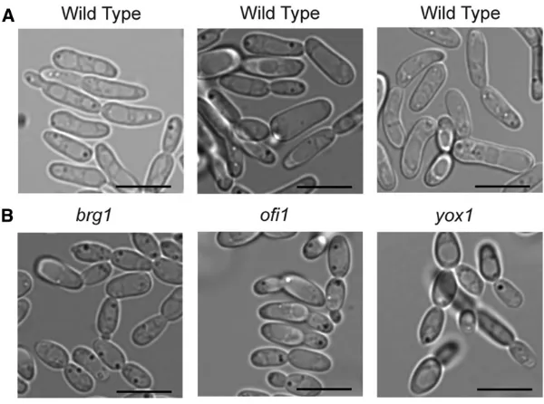 Figure 4 Identimorphology. (A) Images of typical wild-type opaque cells.(B) Images of three deletion mutants that result in ashorter, fatter, more oval opaque cell morphology