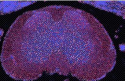 Figure 3.2: Diffusion tensor data from a healthy mouse spinal cord visualization from Laidlaw et al., visualizinganatomical image (underpainting lightness), ratio of largest to smallest eigenvalue (stroke length and width andtransparency), principle direction in the horizontal plane (stroke direction), principle direction in the vertical plane(stroke red saturation), and magnitude diffusion rate (stroke texture frequency).