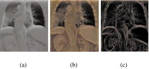 Figure 3.6: Abdominal CT scans: (a) standard CT visualization; (b) silhouette and boundary enhancements; (c)colored outline sketch techniques;