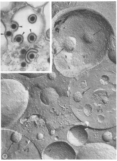 FIG. 11.Instartingshowsareheads). Vl, Cytoplasmic envelopment at 48 hppi. with the Patton strain ofHSV-I1 Different stages of budding detected in these three cytoplasmic vacuoles and can be compared with their aspect in thin sections (inset)