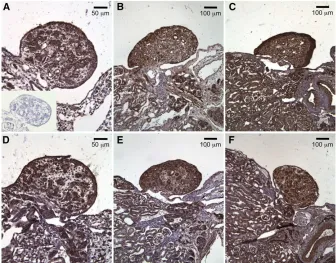 Figure 2 Spatial distribution of CIRBP proteinF). There was no detectable staining in thenegative control when 1was omitted (inset of A)
