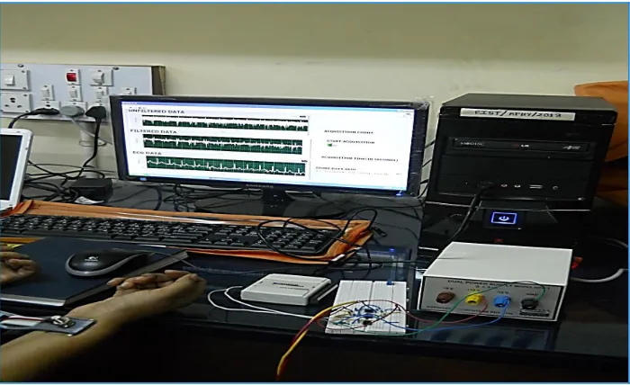 Fig. 8. ECG display on the LabVIEW front panel  
