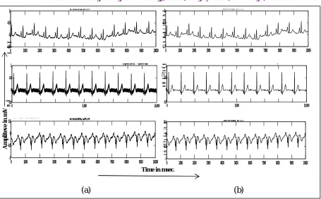 Fig. 10. Visual comparison test results a) Data recorded by MP-150 system by Biopac b) Simultaneous data recorded  by the developed acquisition module 