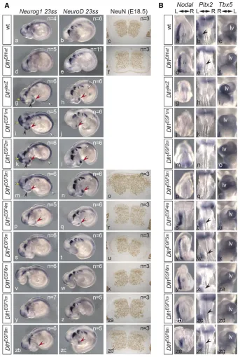 Figure 4 Neuronal differentiation and leftrior halves of embryos were removed prior tohybridization toe, t, w, z, zc, zf) point toleft LPM.tricle normally positioned on the left side