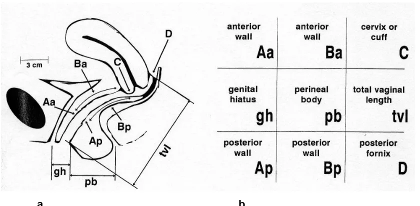Figure 1.5. ICS POPQ. a) Identifies points of reference on the vagina. b) how these 