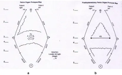 Figure 1.7. A schematic diagram of the paravaginal sulci with anatomical reference 