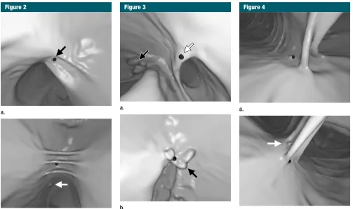 Figure 2Figure 3