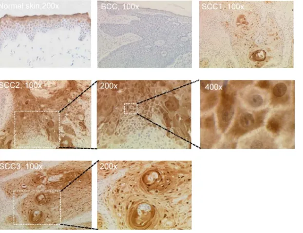 FIG 6 Expression of syntenin-2 in organotypic skin cultures of N/TERT ke-ratinocytes expressing HPV8 E6, E7, or E6E7