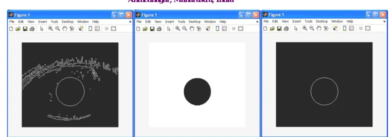 Fig 1 (a) Canny edge image (b) Only pupil (c) Pupil ring 