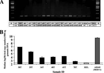 FIG 1 Detection of HCMV DNA in tumor specimens. (A) Nested PCR products run on a 2% agarose gel