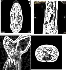 Fig.3 Sample output screen for shape and texture feature extraction 
