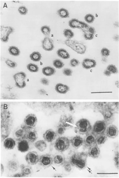 FIG. 3.particlessectionvirionstemperature.arrow).inblack the (A) Uncommon view showing an accumulation ofbudding virions (a), complete assembled normal (b), and multiploids(c) in the intercellular space of ts3-infected cells grown at the nonpermissive Scal