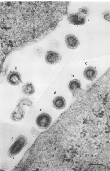 FIG. 4.permissiveand Ts3-infected TB cells grown at the nonpermissive temperature for 48 h and then shifted temperature fortothe 30 min showing extracellular immature normal virions (d) and  normalmultiploids virions (b (e-g) and c) and multiploids (a) at 