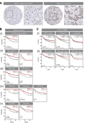 Figure 6: High SASH1 expression is an independent marker of favourable prognosis in ER-positive breast cancer, particularly for low grade and PR co-expressing tumours