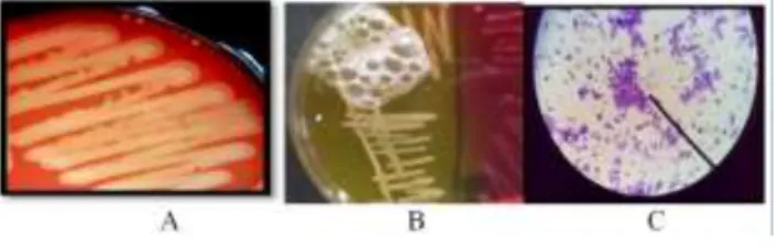 Fig 2.   Streptococcus agalactiae hemolysis in Blood Agar (A), Katalase  positive test (B) and the morphology of Staphylococcus sp purple and 