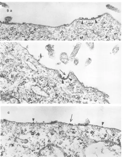 FiG.~~~'tWregionvirusheads)(arrowprominentMicrograph(c) 9. Electron micrographs of the surface of A-9 cells prepared as in Fig