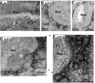 FIG 4 Formation of aberrant spherules that are smaller but 4-fold more abundant in cells lacking ACB1