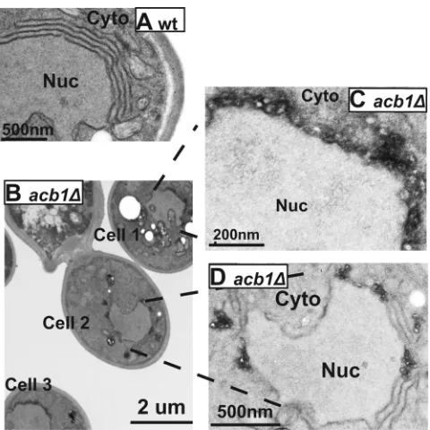 FIG 6 Karmellae are formed normally in acb1� cells. Electron microscopy images of karmella structures in wt (A) and acb1� (B) cells overexpressing yeastHmg1p