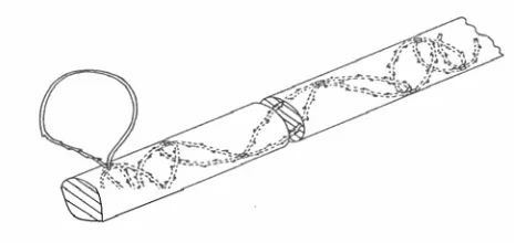 Figure 17.  Finger trap suturing technique for tendon repair 