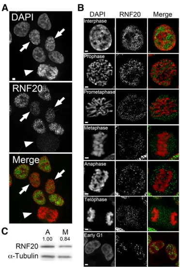 Figure 1sion pattern of RNF20 (green) throughout various stages of the cell cycle(indicated)