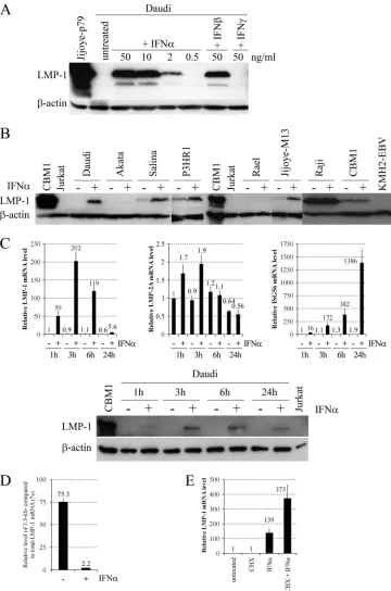 FIG 1 Effects of IFNs on LMP-1 expression in BL lines. (A) Immunoblot analysis of LMP-1 (S12 supernatant) andTotal cell extract of Jijoye-p79 (1) was used as a positive control for LMP-1 protein expression