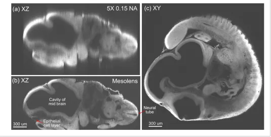 Figure 4. Optical sectioning of an optically-cleared and fluorescently-stained 10 day old mouse embryo