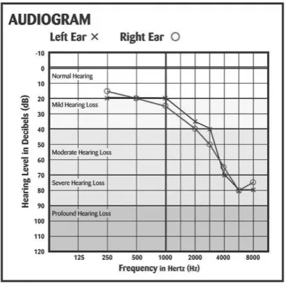 Figure 2.1. Audiogram (ASHA 2015). It’s worth noting that the HL classifications and their ranges are slightly different to the chart in Table 2.1,  as well as the charts cited in Table 2.2