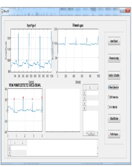 Figure 7 Reconstructed Signal 