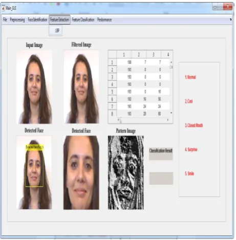 Fig 7 GUI detected image 