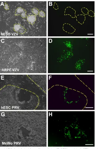 FIG 3 VZV is unable to replicate in hESC when infection is bypassed by transfection of BAC DNA containing the VZV genome