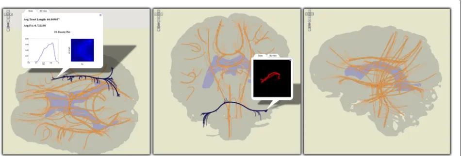 Figure 5 DTI tractography data projected onto the transverse, coronal and sagittal planes